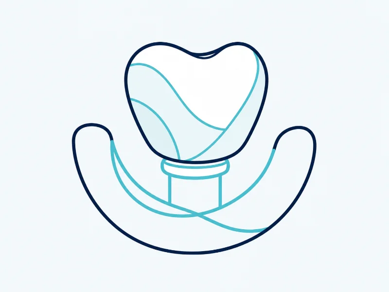 Implantes dentários