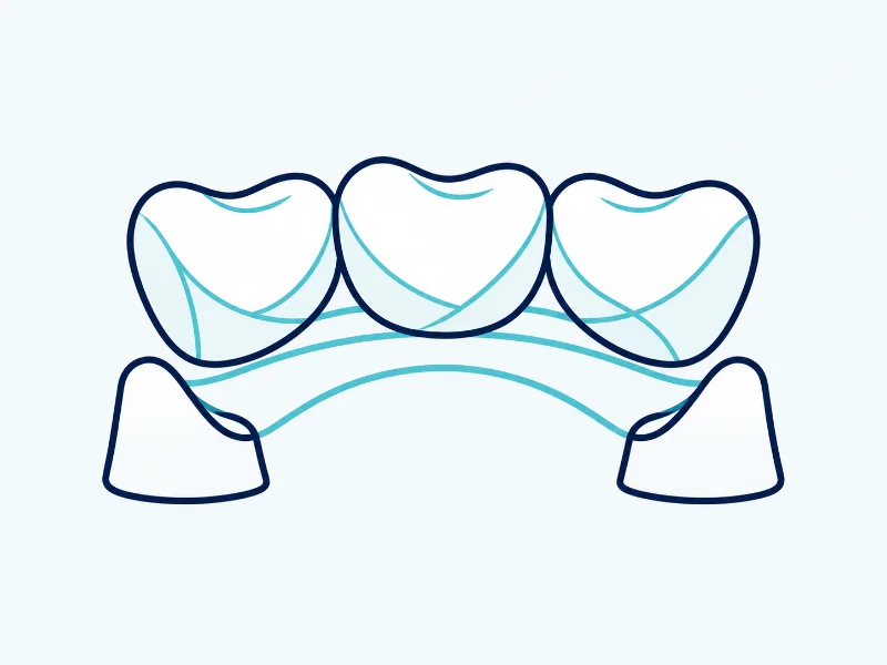 Próteses dentárias