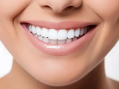 Clareamento dental associado