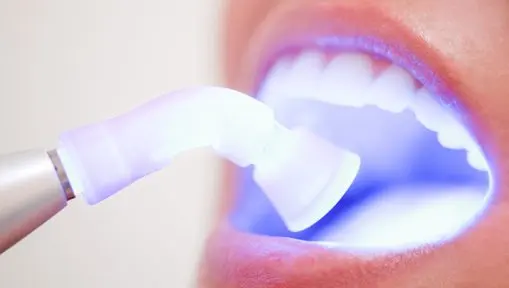 Clareamento dental